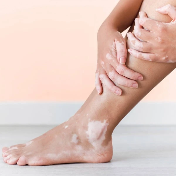 Bloom And Blossom Spritzy Toes Revitalising Leg And Foot Spray 100ml 6 Bloom And Blossom Spritzy Toes Revitalising Leg And Foot Spray 100ml - Image 4